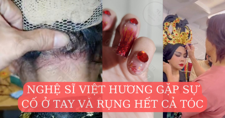 nghe-si-viet-huong-gap-su-co-ong-xa-yeu-thuong-het-minh (1)