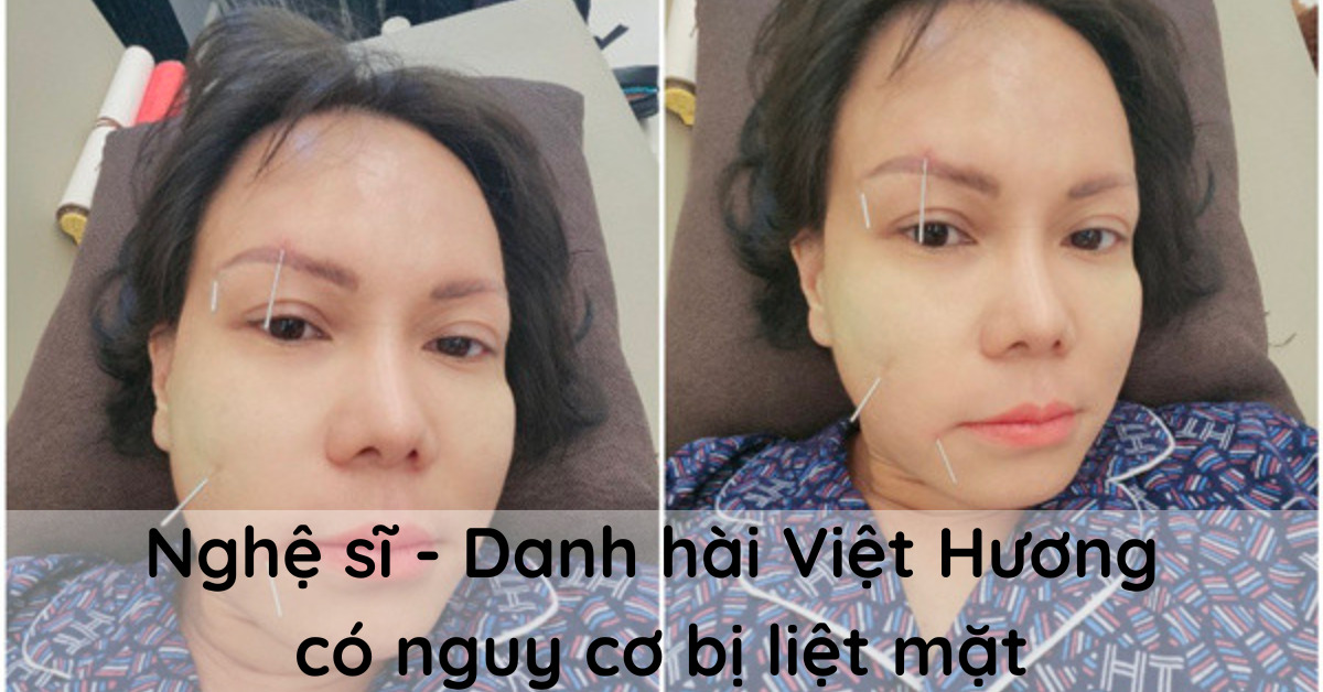 thumbnail Nghệ sĩ Việt Hương có nguy cơ bị liệt mặt vì thói quen này của mọi ngừơi