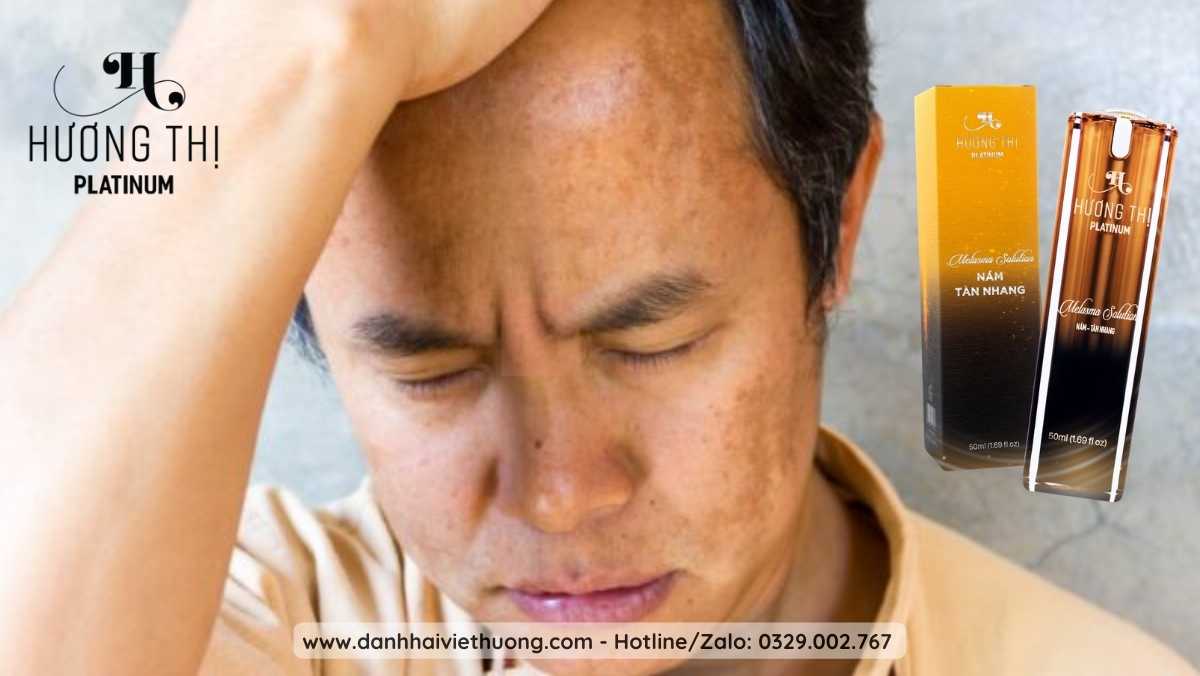 Nam Giới Có Nên Dùng Kem Chữa Nám Hương Thị 2