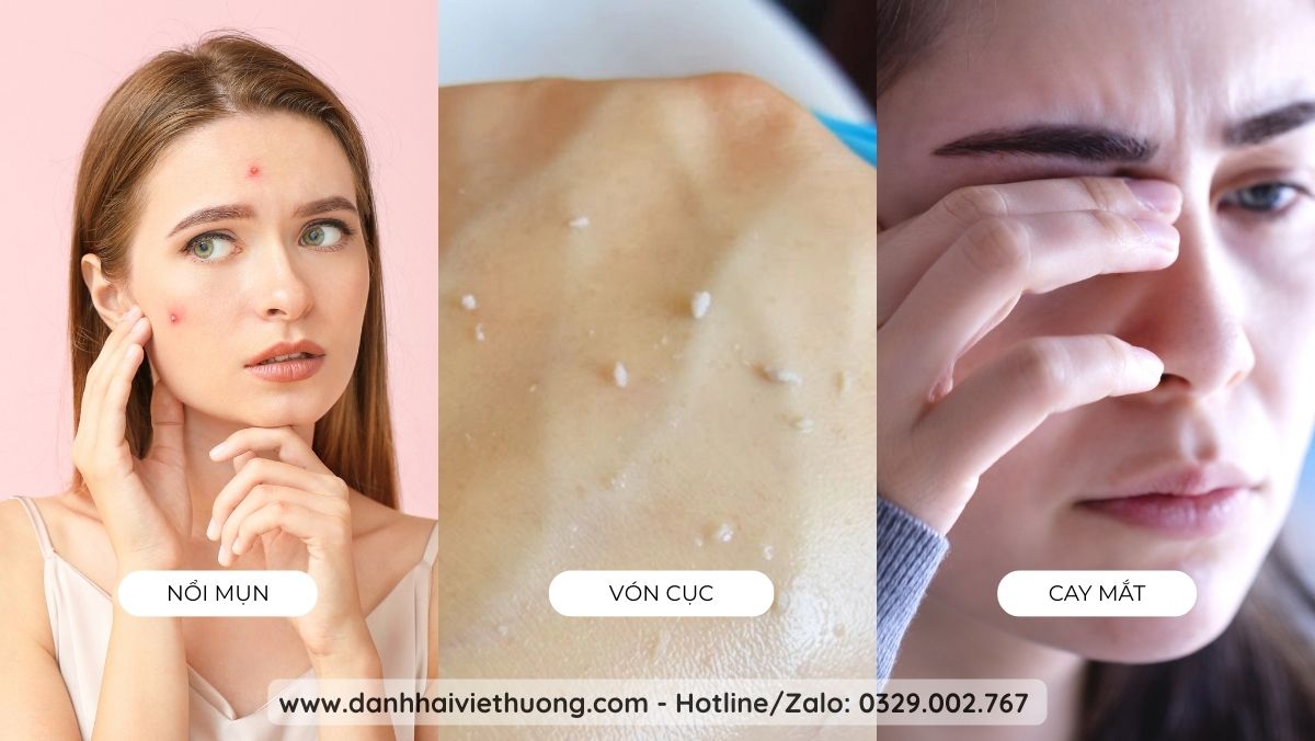 Kem Chống Nắng Toàn Tập Từ A-Z Bảo Vệ Làn Da Hoàn Hảo Trước Tia UV 11
